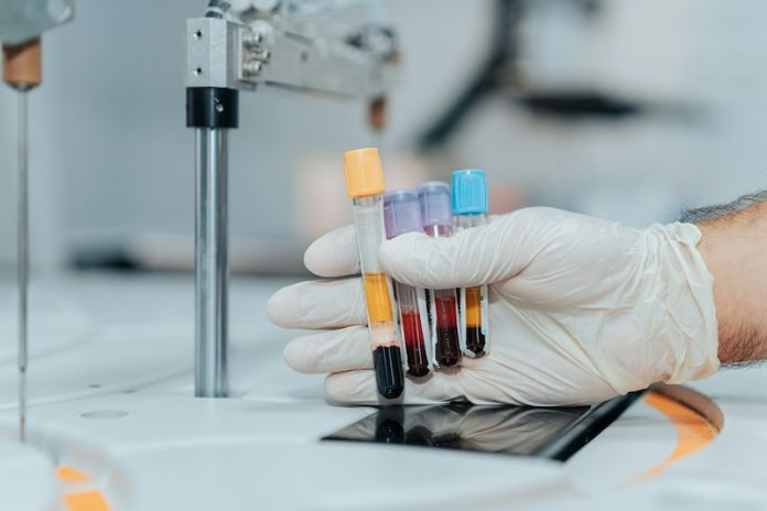 New-blood-test-could-detect-gallbladder-cancer-more-accurately-696x464